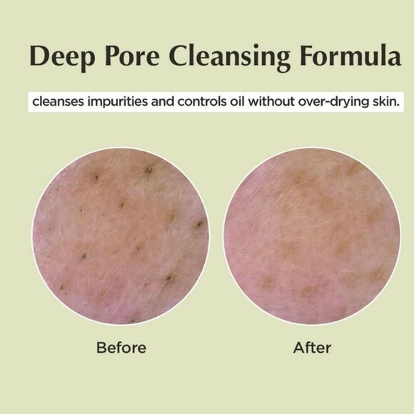 ma:nyo Deep Pore Cleansing Soda Foam Size 5.07 oz - Picture 3 of 7